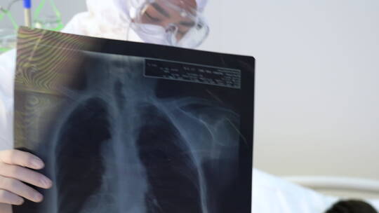 医生给患者查看X光片视频素材模板下载