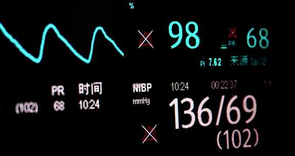 心率检测仪健康监测ICU病房生病住院患者