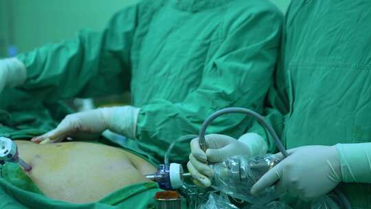 手术室医生做手术
