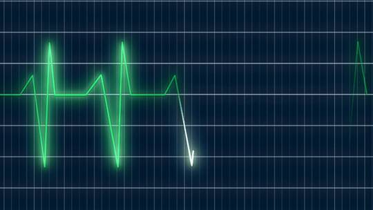 心电图背景医疗医学视频素材模板下载