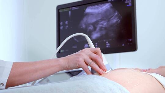 医院内医生的特写镜头对孕妇进行超声波