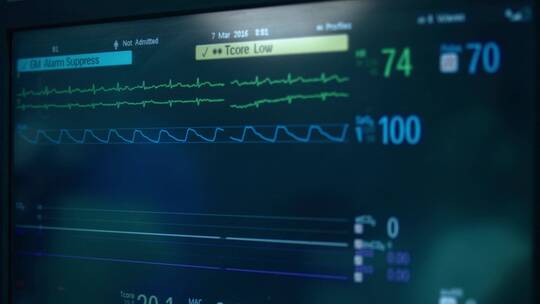医院的心电图机机器视频素材模板下载
