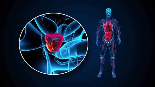 4K前列腺癌的抽象3D动画