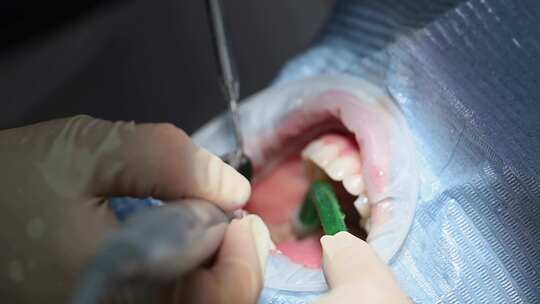 一名牙医在例行牙科检查中为一名妇女刷牙视频素材模板下载