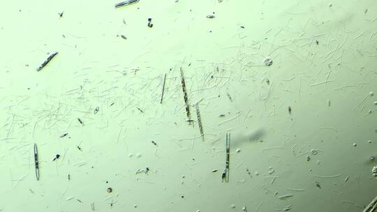 显微镜下的大量细菌与硅藻 放大100倍 1