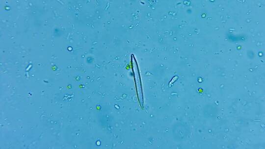 微生物硅藻细菌单细胞原生生物 2视频素材模板下载