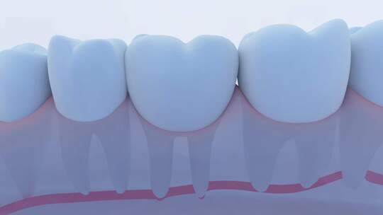 牙齿清洁 护牙 口腔洁白 牙垢清理视频素材模板下载