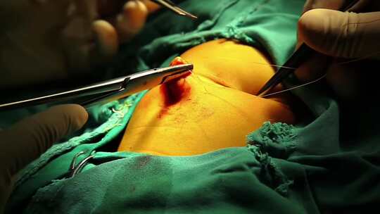 手术室手术台 腹腔微创手术 手术准备工作视频素材模板下载