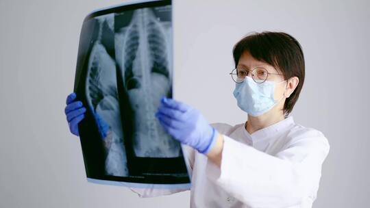 一位女医生在看x光片视频素材模板下载