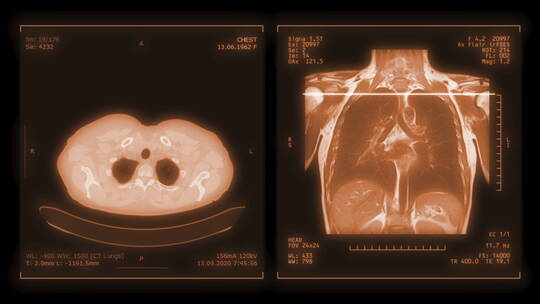 CT 核磁共振 x造影 医学拍片 透视造影