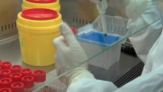 核酸试剂检测 核酸样品检测实验室