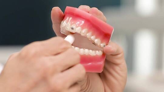 医疗-正畸-咬胶棒演示