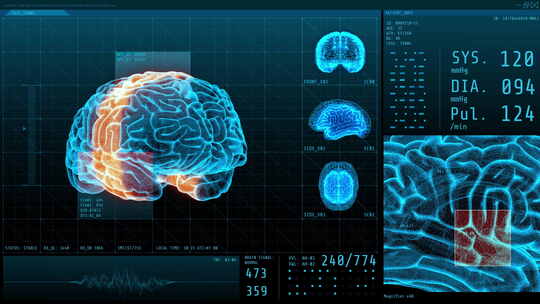 三维大脑和生命体征的统计数据神经学