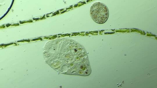显微镜下的真实微生物 喇叭虫4