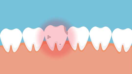 牙齿损坏开始红肿出现问题