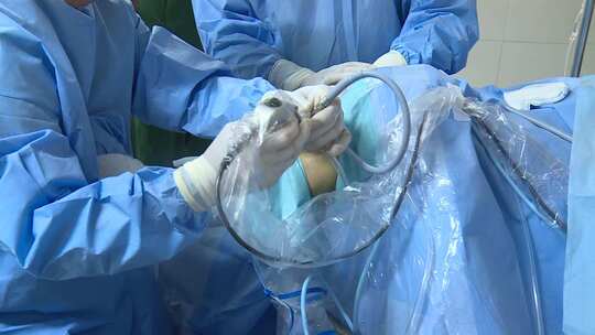 外科微创手术实拍高清视频