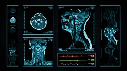 高科技医疗人体器官3D全息扫描投影展示动画视频素材模板下载