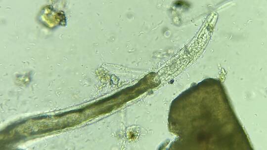 科研科普素材 死去的线虫被细菌围绕