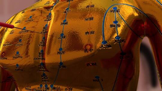 中医铜人针灸视频素材模板下载