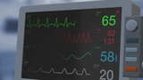 心电图心电图监护仪高清在线视频素材下载