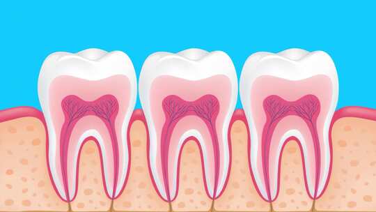 牙齿内部结构图，显示蛀牙侵蚀情况