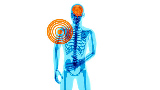 4K肩痛的解剖学概念