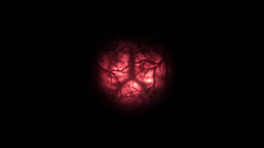 4k树状的血管红色球眼球 (1)