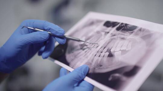 看牙，牙科，医疗器械 x光片视频素材模板下载