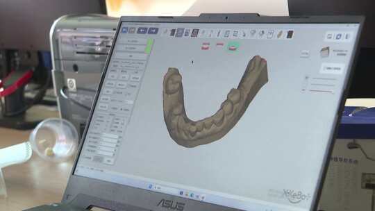 牙科医院机器人科技种植牙视频素材模板下载