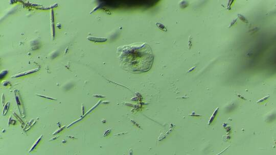显微镜下的微观世界微生物 硅藻4