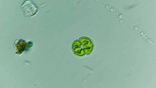 显微镜下放大400倍的鼓藻