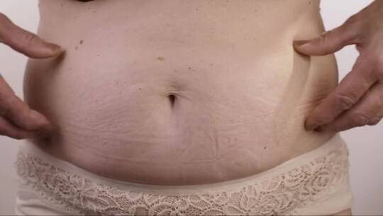 肥胖的女人触摸她的胃