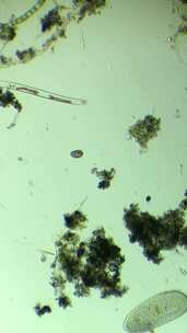 微分干涉DIC显微镜放大100倍的微生物喇叭虫细胞3