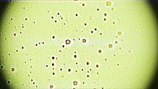 显微镜下的有机微生物