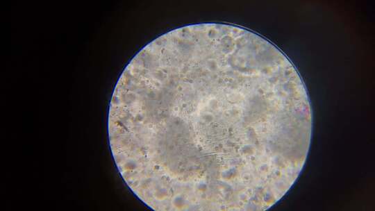 显微镜下精子运动4