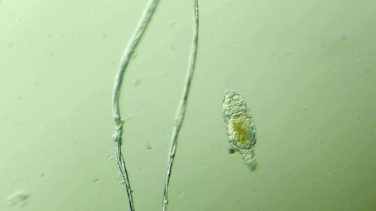 生命科学纪录片素材，显微镜下的生物，轮虫9
