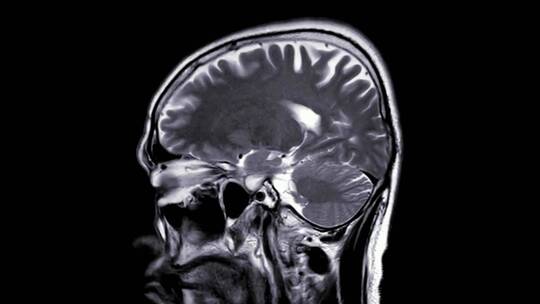大脑头部CT扫描视频素材模板下载