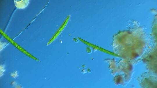 显微镜下的微观世界微生物 新月藻3