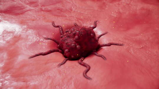 消除肿瘤细胞癌细胞肿瘤化疗