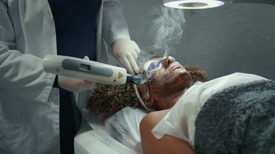 激光脉冲患者面部特写化妆师手剥皮去角质皮