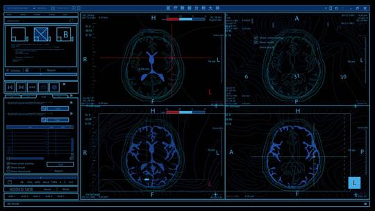 医疗可视化数据大屏分析AE模板文件夹AE视频素材教程下载