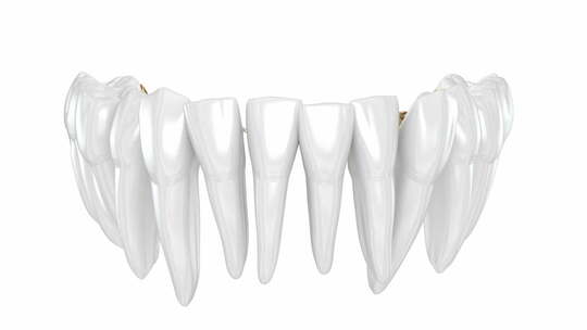 舌金色牙套系统。牙科3D动画