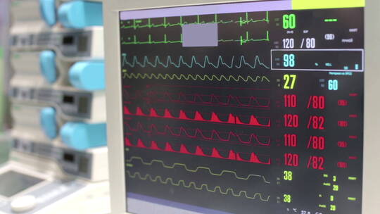 心电图监护仪正在工作