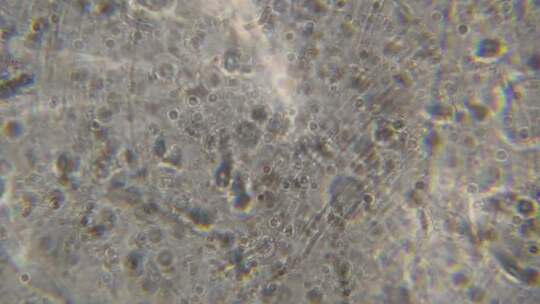 显微镜下精子运动6