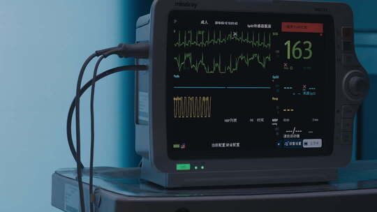 医院心电监护仪画面