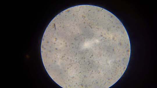 显微镜下精子运动