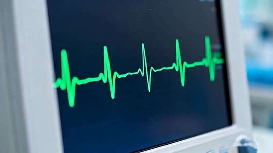 医疗设备显示心电图画面