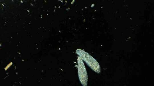显微镜下的真实微生物 草履虫 2