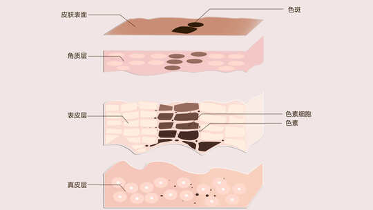 色素型皮肤分层和组合动画