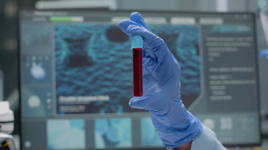 试管血液样本分析视频素材模板下载
